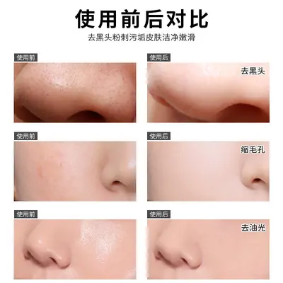 金妮雅吸出黑头鼻膜收缩毛孔祛黑头男女清洁粉刺撕拉面膜厂家直销