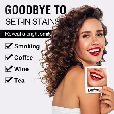 Teeth whitening strips, non-acidic and safe for sensitive teeth