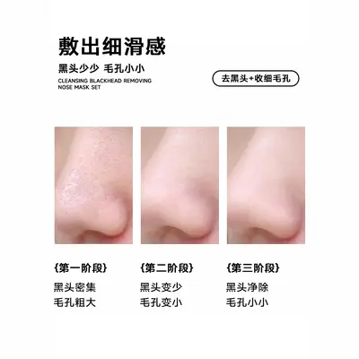 柏翠丝去黑头鼻贴收毛孔闭口粉刺导出贴清洁草莓鼻青少年敏肌适用