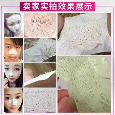 Garysoon White Aloe Gel Blackhead Nose Strip, Unisex - 4