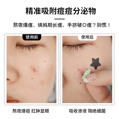 20粒花朵痘痘贴遮瑕可上妆水胶体贴可爱多色水胶体一次性痘痘贴