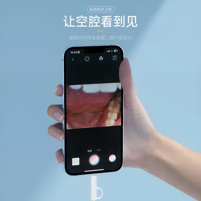 口腔内窥镜可视新款高清可视口腔仪牙镜护理清洁检牙仪牙科工具