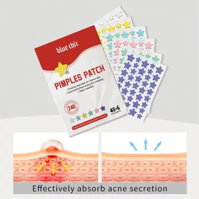 Gentle Non-Irritating Acne Patches for Blemish and Blackhead Fading - 3