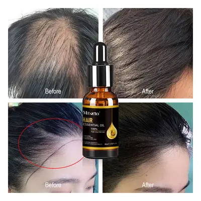 跨境热销 护发精油Thrive Hair Growth Oil 润发养发头发头皮护理