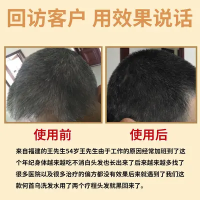 Heshouwu Ganoderma Shampoo, Ölkontrolle und feuchtigkeitsspendend - 4