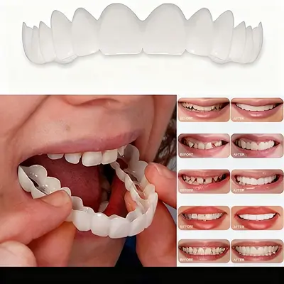 Silicone Whitening Temporary Tooth Veneers, Upper and Lower