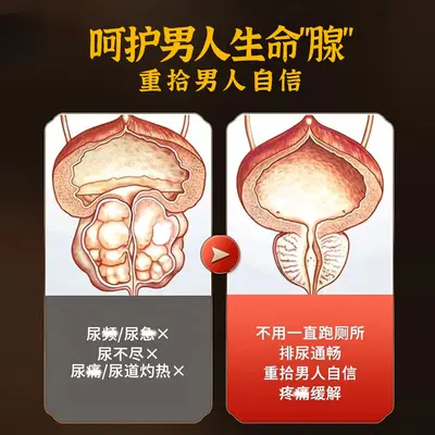 前列腺保健贴厂家批发男性成人穴位贴肚脐贴植物草本温阳元膏贴