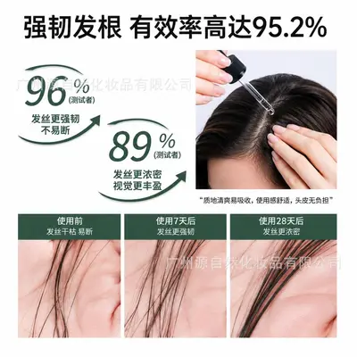 腺苷生发液激活毛囊防脱育发液头皮精华液当归生发液猛长头跨境 - 3