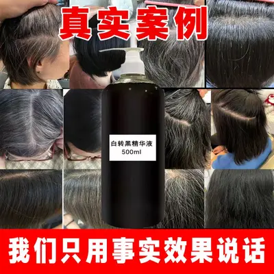 White to Black Hair Essence Polygonum Multiflorum