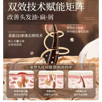 洗发水代加工控油蓬松去屑止痒持久留香洗头膏软塌油男女士洗发水 - 3
