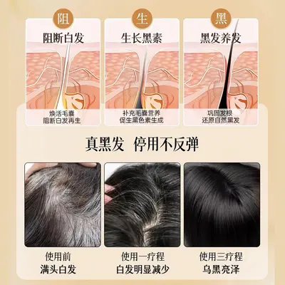 何首乌白转黑精华液白发养黑发原液黑灵芝养发乌发生发滋养育发液 - 4