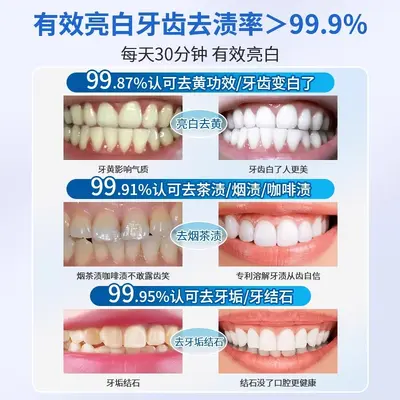 Whitening dental strips for yellow stain removal and teeth brightening