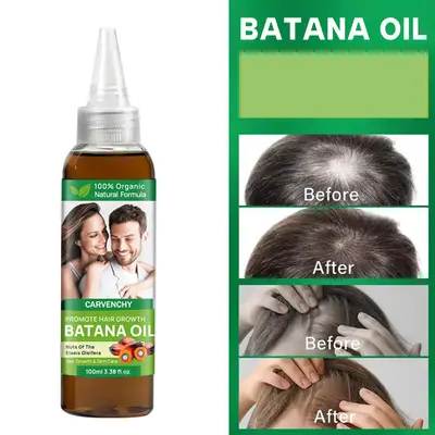 跨境货源HAIR GROWTH BATANA OIL原始巴塔纳油天然头发修护精油