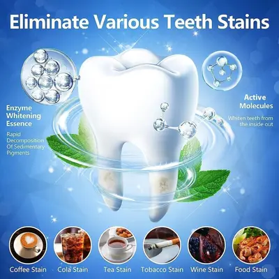 Mint-flavored teeth whitening strips that remove stains gently