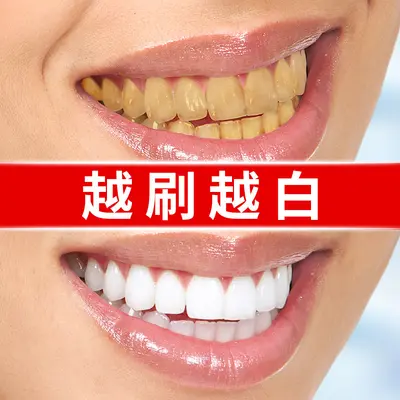 Fast Teeth Whitening Pen for Yellow Teeth, Smoke and Tea Stains