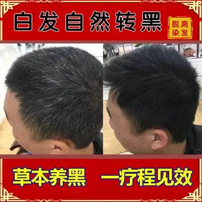 Black Ganoderma and He Shou Wu Herbal Shampoo, Darkens Gray Hair, Anti Hair Loss - 4