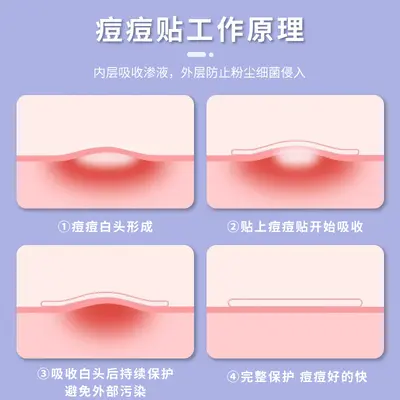 笑脸痘痘贴彩色图案镶钻爱心遮瑕贴物理吸脓水胶体可上妆趣味吸睛