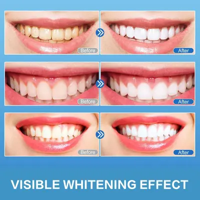 PAP whitening strips non-peroxide customizable