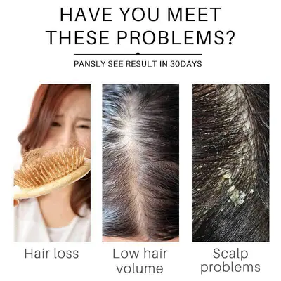 Hair Growth Shampool头发滋润保湿修护洗发水柔顺温和清洁洗发水