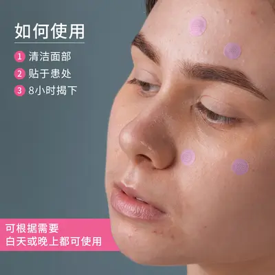 Pink Dissolving Microneedle Acne Patch with Hyaluronic Acid - 4