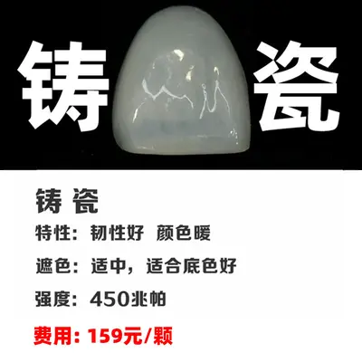 Full Porcelain Dental Veneers, Domestic Porcelain Tooth Veneer Patches - 7