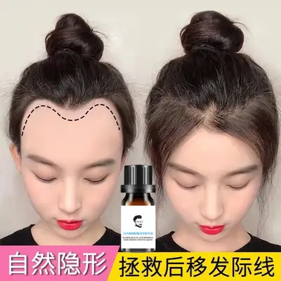 Saç Çizgisi Büyütücü Serum Saç Besleyici Bakım Sıvısı Dökülme Önleyici Yoğunlaştırıcı Sıvı Saç Bakım Yağı Kafa Derisi Serumu Saç Çıkarıcı Ürün