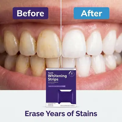 V34 Purple Teeth Whitening Strips Set, Removes Yellowing, Gentle Cleaning - 5