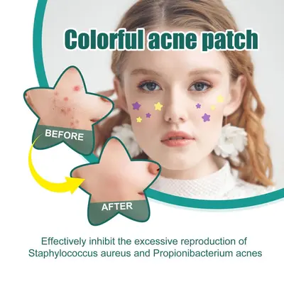 EELHOE Star-Shaped Acne Patches, Gentle Facial Cleansing Care