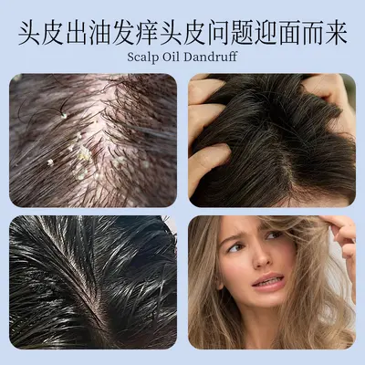 金鸡纳去屑洗发水控油蓬松去屑止痒头皮净化改善毛躁香味持久洗发