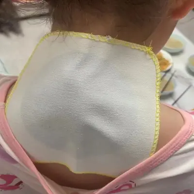 Nasal Breathing Patch for Adults and Children, Relieves Allergic Congestion and Itching, H