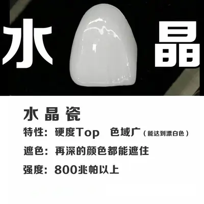3D全瓷贴面超薄美白牙贴片蓝瓷琥珀灵犀瓷遮丑牙贴美牙修复体