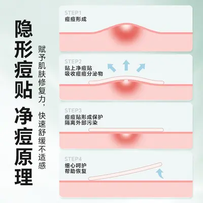 Hydrocolloid Acne Patches, 36 Pieces, Thin and Breathable