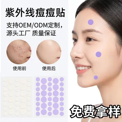 水胶体痘痘贴 紫外线吸脓轻薄透气祛痘贴源头工厂支持定制