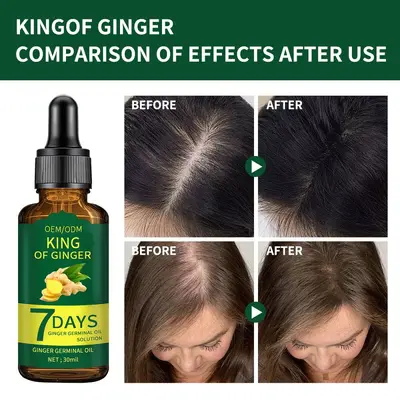 亚马逊爆款生姜Hair growth精华油7天生姜头皮精华液滋养发根 OEM