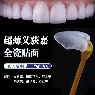 Full Porcelain Dental Veneers, Domestic Porcelain Tooth Veneer Patches - 2