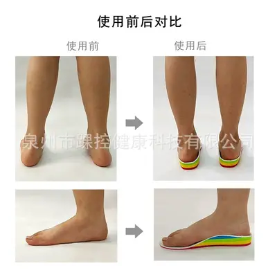 3D Printed Arch Support Insoles for Flat Feet, Kids and Adults - 4