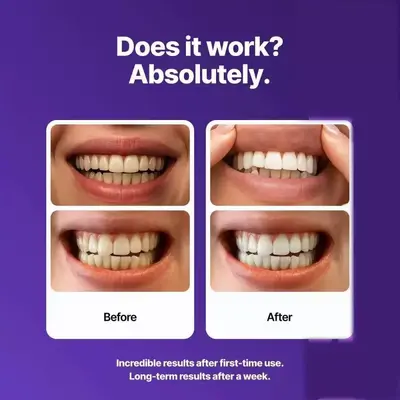 Dr Dent Diş Beyazlatma Şeritleri Mor - 4