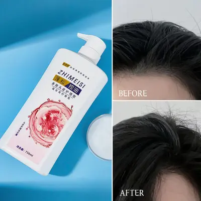 Refreshing Anti-Dandruff Shampoo 750ml, Oil Balancing, Household Size - 2
