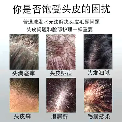 Fuchiting coal tar anti-dandruff shampoo, antibacterial, deep cleansing - 3