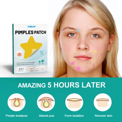 VIBEUP Star-Shaped Acne Patches, Breathable and Portable, for Teen Skin - 3