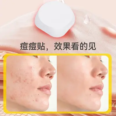 跨境红光痘痘贴精准净痘纽扣祛痘贴隔离舒缓淡化痘印吸痘贴