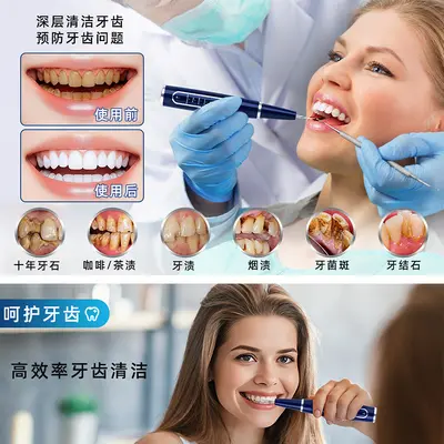 Ultrasonic Teeth Cleaner for Tartar Removal, Home Electric - 4
