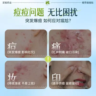 妥能痘痘贴水杨酸积雪草艾草精油祛痘吸收渗液轻薄黏贴