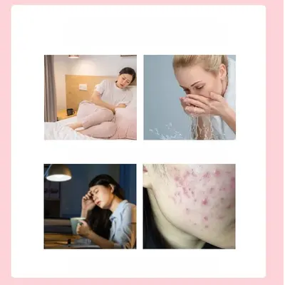 Tokyo Pharmaceutical Acne Patch, Invisible Transparent Cover, Day and Night - 3