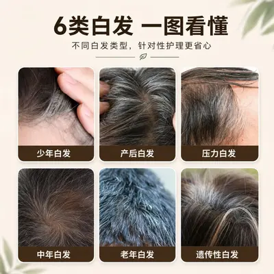 白转黑精华液乌黑滋养液滋养毛囊坚韧发根育发液防脱膏何首乌草本 - 3