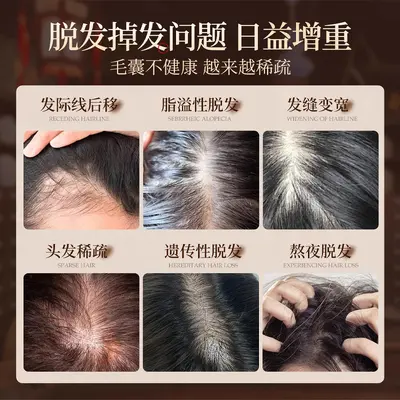定制侧柏叶黑灵芝草本植物乌发养发液生姜育发液控油蓬松厂家贴牌