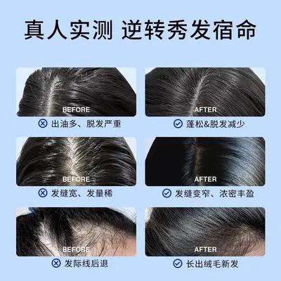 EHD Anti-Hair Loss Shampoo, Oil Control, Volume and Smoothness, Unisex - 3