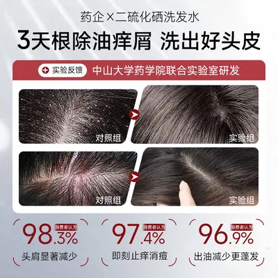 Selenium Disulfide Anti-Dandruff Shampoo, Oil Control and Volumizing, Large Capacity