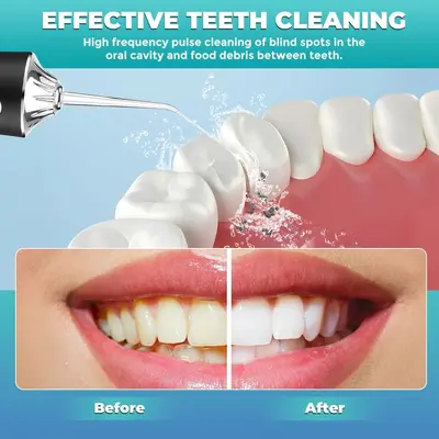 Portable Electric Water Flosser for Home Oral Irrigator - 5