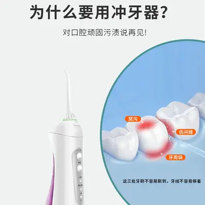 Electric Portable Water Flosser, Smart Oral Irrigator for Interdental Cleaning - 4